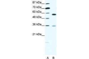 Western Blotting (WB) image for anti-GDP Dissociation Inhibitor 1 (GDI1) antibody (ABIN2463768) (GDI1 anticorps)