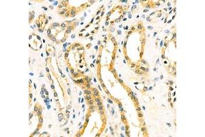 Immunohistochemistry of paraffin embedded human kidney using Aminome (ABIN7073036) at dilution of 1: 400 (400x lens)