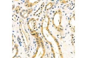 Immunohistochemistry of paraffin embedded human kidney using Aminome (ABIN7073036) at dilution of 1: 400 (400x lens) (Aminomethyltransferase anticorps)