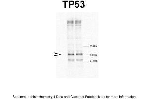 WB Suggested Anti-TP53 Antibody Titration: 1 ug/mlPositive Control: HeLa cells