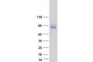 Validation with Western Blot (UGT1A3 Protein (Myc-DYKDDDDK Tag))