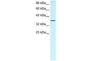 WB Suggested Anti-HOXA7 Antibody Titration:  0. (HOXA7 anticorps  (N-Term))