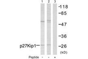 Western blot analysis of extracts from A2780 cells, using p27 Kip1 (Ab-10) Antibody. (CDKN1B anticorps  (AA 1-50))
