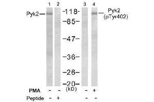 Image no. 2 for anti-PTK2B Protein tyrosine Kinase 2 beta (PTK2B) (pTyr402) antibody (ABIN196952)