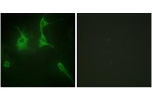 Immunofluorescence analysis of NIH-3T3 cells, using Collagen IX alpha3 Antibody. (COL9A3 anticorps  (AA 321-370))