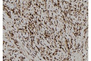 ABIN6277680 at 1/100 staining Human gastric tissue by IHC-P. (NLRP3 anticorps)