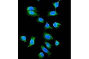 IF analysis of Galectin 1 using anti-Galectin 1 antibody (ABIN5518716). (LGALS1/Galectin 1 anticorps  (AA 2-135))