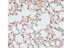 Immunohistochemistry of paraffin-embedded Mouse lung using ZNF141 Polyclonal Antibody at dilution of 1:100 (40x lens). (ZNF141 anticorps)