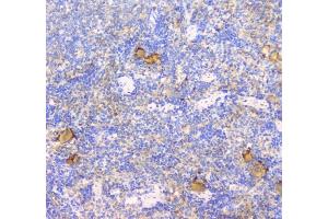 IHC analysis of CD229 using anti-CD229 antibody (ABIN6719290). (LY9 anticorps)
