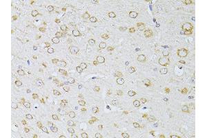 Immunohistochemistry of paraffin-embedded mouse brain using NTS antibody (ABIN5998396) at dilution of 1/100 (40x lens). (Neurotensin anticorps)