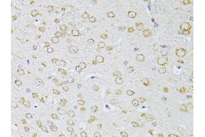 Immunohistochemistry of paraffin-embedded mouse brain using NTS antibody (ABIN5998396) at dilution of 1/100 (40x lens).
