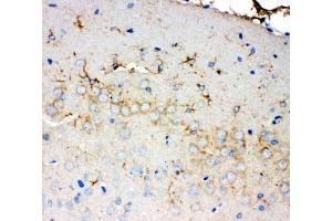 IHC-P: PMP70 antibody testing of rat brain tissue