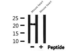 Western blot analysis of extracts from mouse heart, using CBX5 Antibody.
