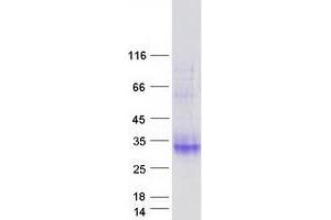 Validation with Western Blot