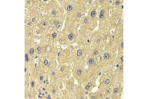 Immunohistochemistry of paraffin-embedded Human liver injury using ALDH1L1 antibody at dilution of 1:100 (x400 lens).