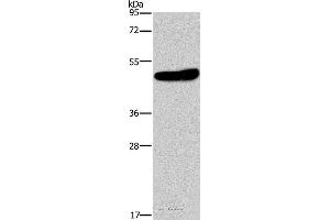 Western blot analysis of Mouse brain tissue, using KCNG2 Polyclonal Antibody at dilution of 1:650