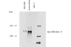 Western blotting analysis of human neurofilament H protein using mouse monoclonal antibody NF-05 on lysates of HEK-293 cell line, human brain lysate, and MCF-7 cell line (neurofilament non-expressing cell line, negative control) under reducing conditions. (NEFH anticorps)