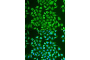 Immunofluorescence analysis of U2OS cell using PIP antibody. (PIP anticorps)
