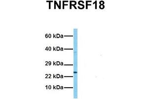 Host:  Rabbit  Target Name:  TNFRSF18  Sample Tissue:  Human HCT116  Antibody Dilution:  1. (TNFRSF18 anticorps  (C-Term))