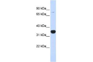 RHOT1 antibody used at 1 ug/ml to detect target protein.