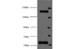 Western Blot analysis of Hela cells using CD45 Monoclonal Antibody at dilution of 1:2000.