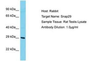 Image no. 1 for anti-Synaptosomal-Associated Protein, 29kDa (SNAP29) (AA 141-190) antibody (ABIN6750423) (SNAP29 anticorps  (AA 141-190))
