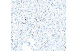 Immunohistochemistry (IHC) image for anti-CD8a Molecule (CD8A) (AA 28-194) antibody (ABIN7453877) (Recombinant CD8 alpha anticorps  (AA 28-194))