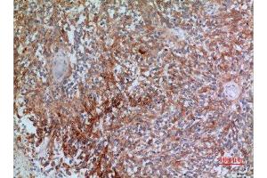 Immunohistochemistry (IHC) analysis of paraffin-embedded Human Brain, antibody was diluted at 1:100.