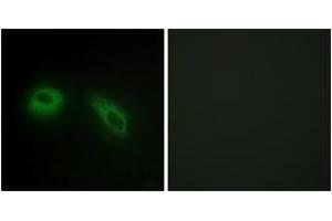 Immunofluorescence analysis of HeLa cells, using GLU2B Antibody. (PRKCSH anticorps  (AA 81-130))