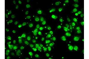 Immunofluorescence analysis of MCF7 cells using QKI antibody (ABIN6128587, ABIN6146533, ABIN6146534 and ABIN6222826).