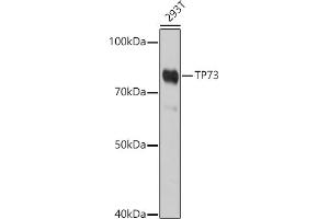 Western blot analysis of extracts of 293T cells, using TP73 antibody (ABIN6133470, ABIN6149430, ABIN6149431 and ABIN6213831) at 1:1000 dilution. (Tumor Protein p73 anticorps  (AA 1-100))