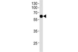Western blot analysis of recombinant protein using KLF4 antibody at 1:1000.