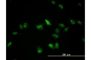 Immunofluorescence of monoclonal antibody to TFEB on HeLa cell.