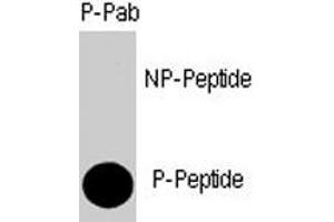 Dot blot analysis of SMAD4 (phospho T277) polyclonal antibody  on nitrocellulose membrane. (SMAD4 anticorps  (Thr277))