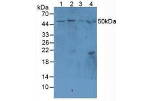 Figure. (MADCAM1 anticorps  (AA 29-297))