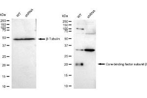 Western blotting analysis using Core-binding factor subunit beta antibody (ABIN7798155).