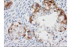 Image no. 9 for anti-BAI1-Associated Protein 2 (BAIAP2) antibody (ABIN1496805) (BAIAP2 anticorps)