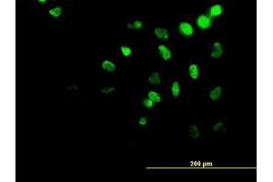 Immunofluorescence of monoclonal antibody to HOXA11 on HeLa cell.