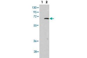 Western blot analysis of PIAS1 (arrow) using PIAS1 polyclonal antibody . (PIAS1 anticorps  (C-Term))