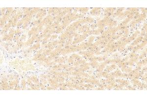 Detection of HNF4a in Human Liver Tissue using Polyclonal Antibody to Hepatocyte Nuclear Factor 4 Alpha (HNF4a)