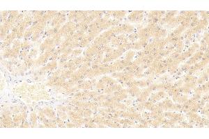 Detection of HNF4a in Human Liver Tissue using Polyclonal Antibody to Hepatocyte Nuclear Factor 4 Alpha (HNF4a) (HNF4A anticorps  (AA 131-330))