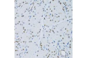 Immunohistochemistry of paraffin-embedded mouse pancreas using SNRNP70 antibody.