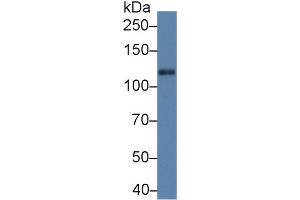 Western Blot; Sample: Rat Cerebrum lysate; Primary Ab: 5µg/ml Rabbit Anti-Rat Slit1 Antibody Second Ab: 0.