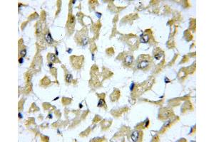 IHC analysis of paraffin-embedded human heart tissue, using SLN antibody (1/100 dilution, 40X lens). (SLN anticorps)
