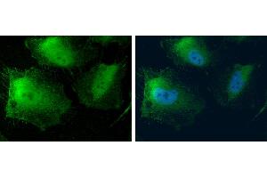 ICC/IF Image MTAP antibody [N1C3] detects MTAP protein at cytoplasm and nucleus by immunofluorescent analysis.