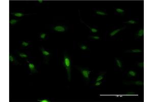 Immunofluorescence of monoclonal antibody to PDX1 on HeLa cell. (PDX1 anticorps  (AA 109-208))