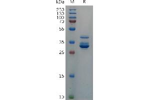 Chemokine (C-X-C Motif) Ligand 10 (CXCL10) (AA 22-98) protein (Fc Tag)
