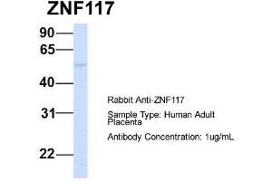 Host:  Rabbit  Target Name:  ZNF117  Sample Type:  Human Adult Placenta  Antibody Dilution:  1. (Zinc Finger Protein 117 anticorps  (N-Term))