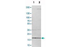 Western blot analysis of cell lysates with MRPL52 polyclonal antibody  at 1:250-1:500 dilution.