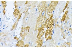 Immunohistochemistry of paraffin-embedded Rat heart using CALR Polyclonal Antibody at dilution of 1:100 (40x lens). (Calreticulin anticorps)